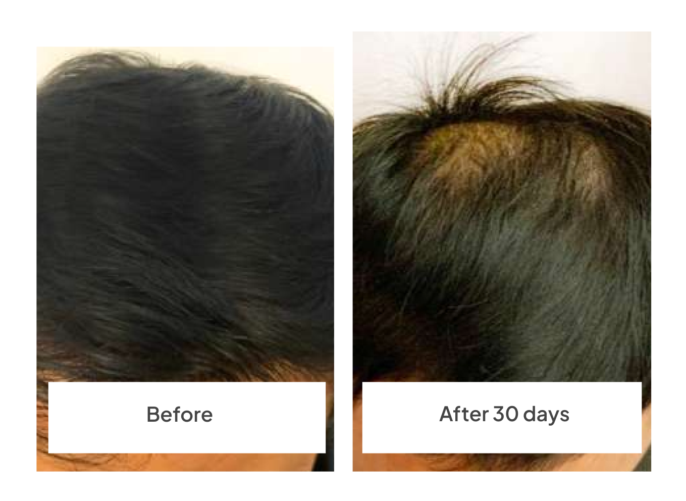 before-after_30_days