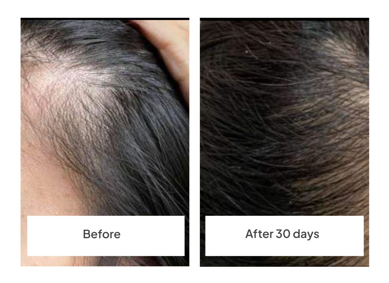 before-after_30_days