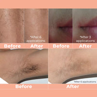 LumiSilk Hair Removal